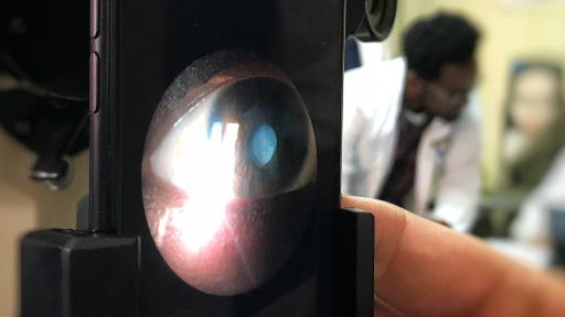 Using a phone to examine images of an eye